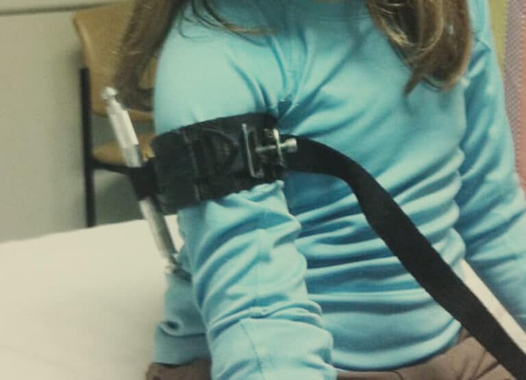A photograph of a young girl wearing a 1-inch SOFT-T tourniquet. The tourniquet worked on the kid, as proven by doppler ultrasound.