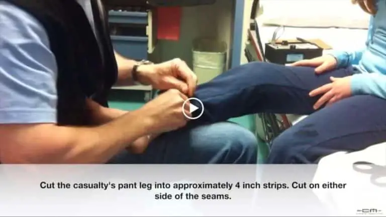 Dr. Shertz’s pant leg improvised tourniquet is demonstrated on a 9-year old girl, and confirmed with a doppler ultrasound, the blood to the limb is occluded.