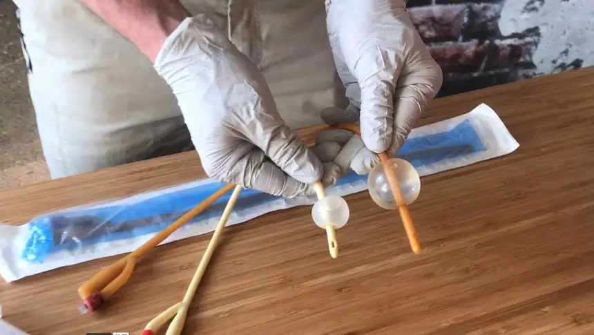 A Foley Catheter (designed for urine drainage) is used to tamponade bleeding where there is a junctional hemorrhage