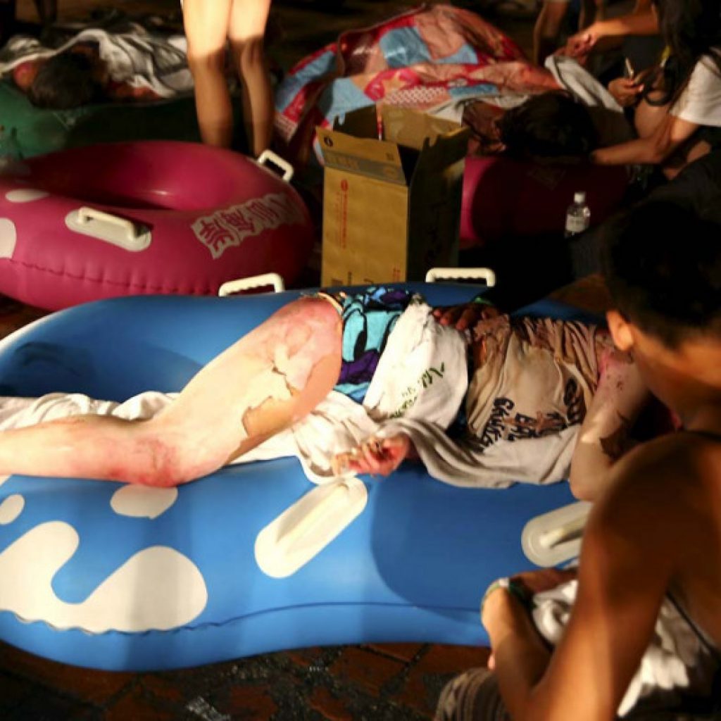 A burn casualty lays across an inflatable pool toy during a burn MCI in Taiwan