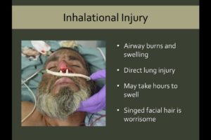 A slide from the Burn section of CM online courses, including issues for inhalation, showing a photo of a burn victim on O2