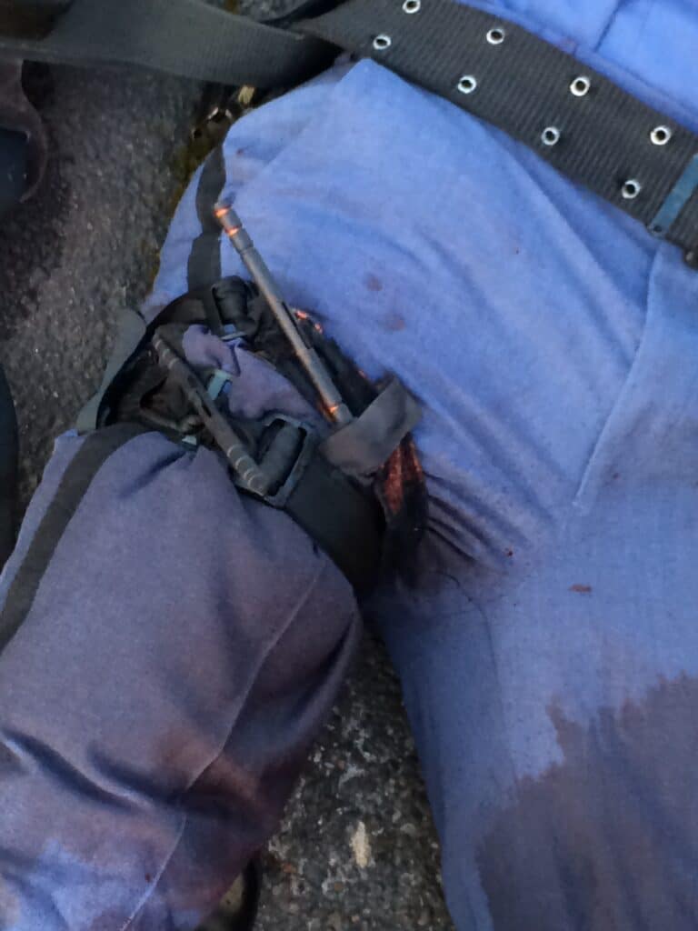 A photo of a police officer's leg showing two, side-by-side CAT tourniquets properly applied to stop massive hemorrhage