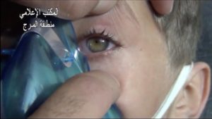 A Syrian video showing a child, presumably nerve agent poisoned in 2013, with pinpoint pupil reactions
