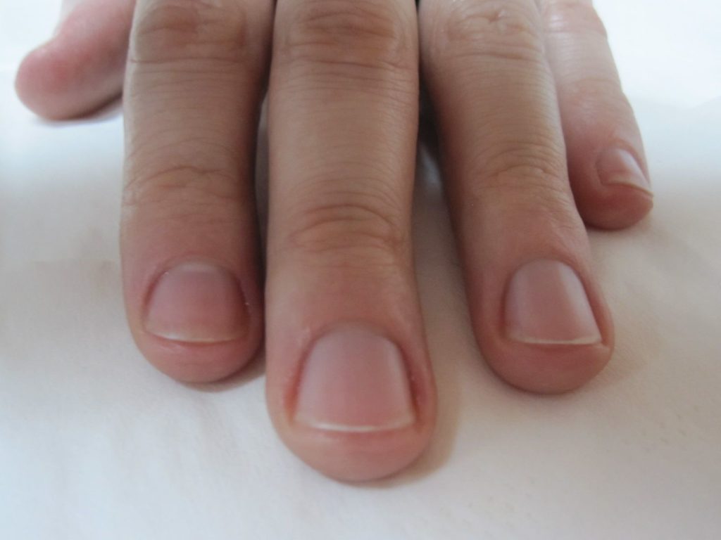 A photo showing a man's fingernails