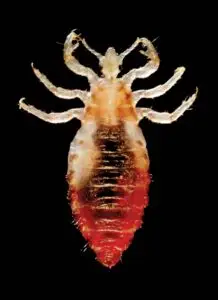 Image of engorged body louse.