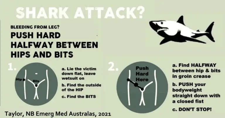 Australian explanation of kneeling in the groin. "Shark attack? Push hard halfway between hips and bits"