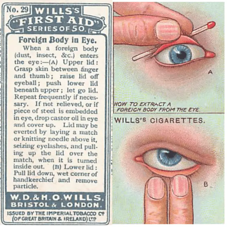 Willlis Cigarette First Aid Cards describing how to remove a foreign body in the eye