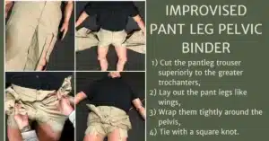 a diagram showing the four steps in an improvised pant leg pelvic binder