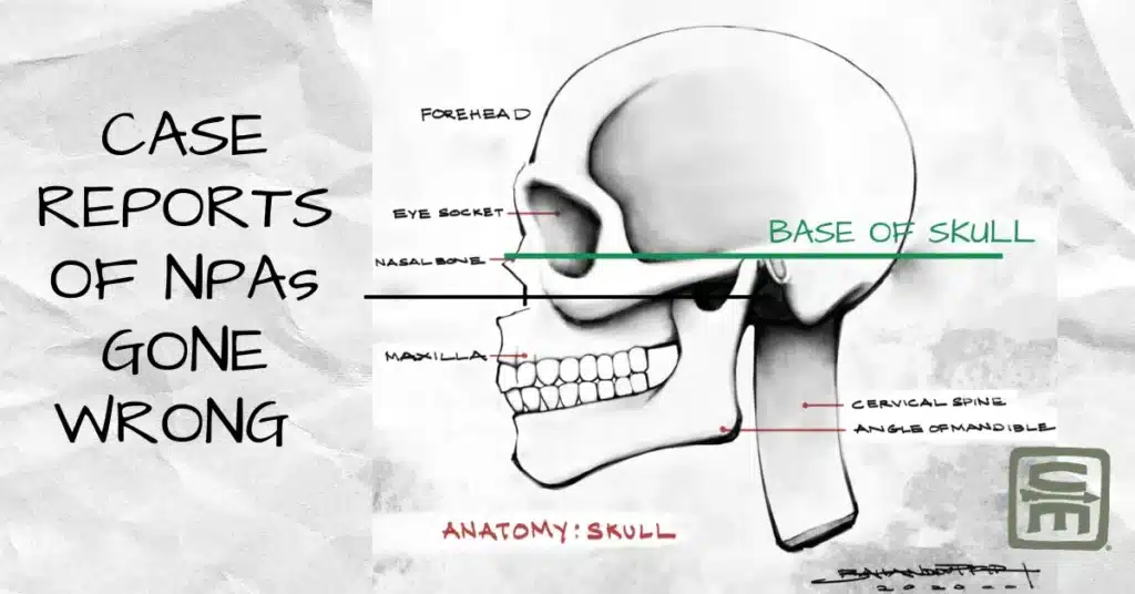 An artistic diagram of a skull showing the base of the skull
